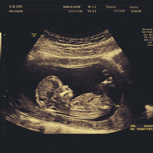 国产成人无码网站m3u8
